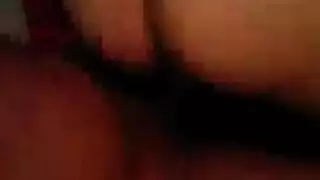 تقلصات التشوة